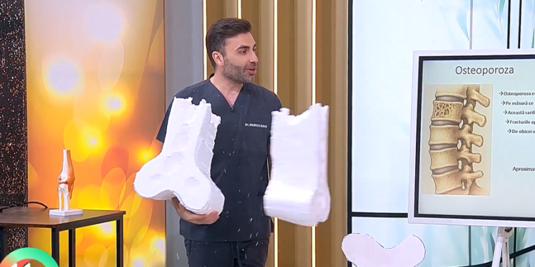 Osteoporoza, boala care „fură” din oase fără să doară. Primele semne pe care mulți le ignoră