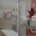 Târgu Jiu: O nouă unitate de imagistică medicală, realizată cu fonduri europene